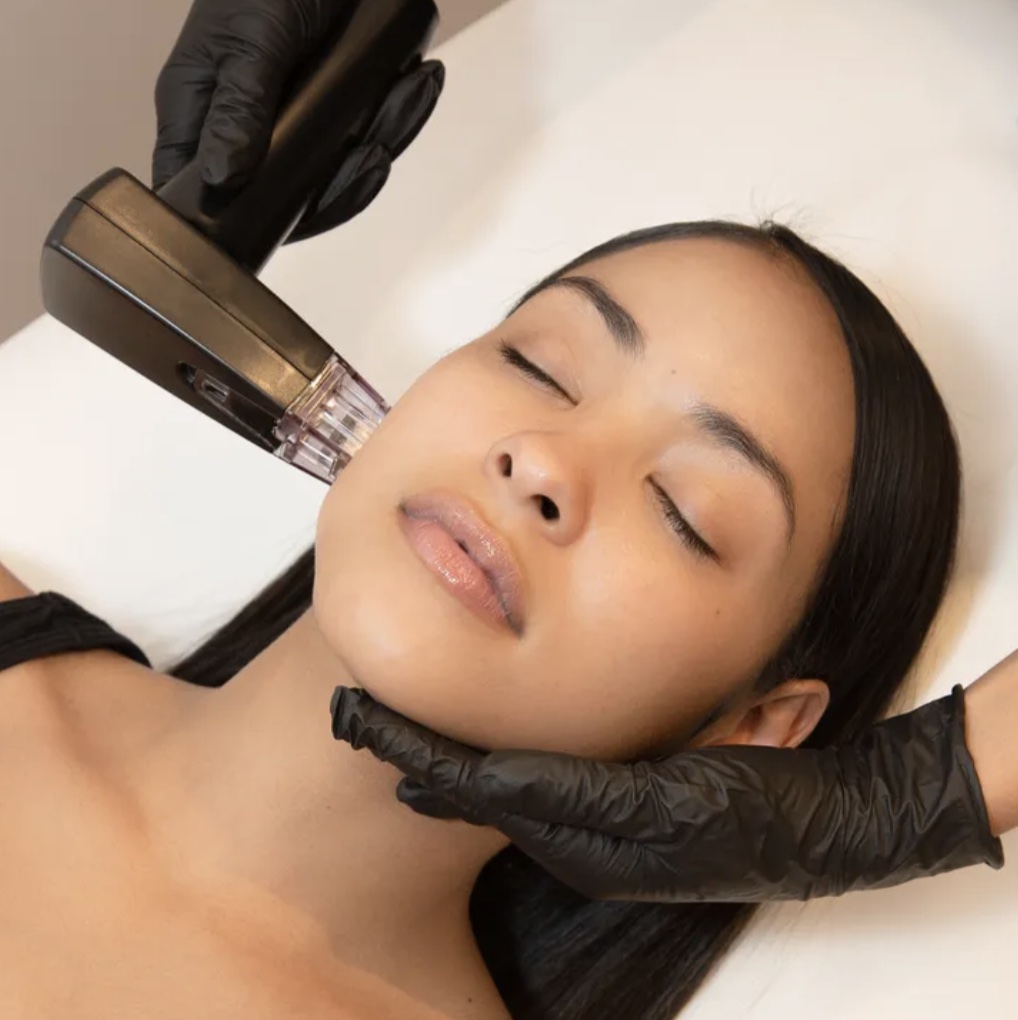 Alliant Huffpost Cosmetic Micro Procedures